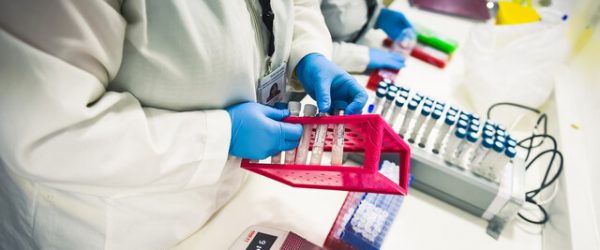Examenes PCR casos activos Covid-19 variante Delta