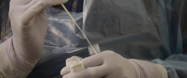 ¿Cuánto demora un PCR versus un test de antígenos en entregar resultados?
