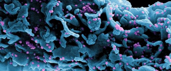 Micrografía electrónica de barrido coloreada de una célula (azul) infectada con una cepa variante de partículas del virus SARS-CoV-2.