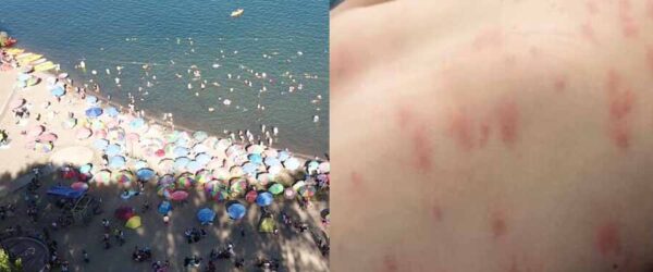 Denuncian balnearios municipales en Quillón por alergias en visitantes