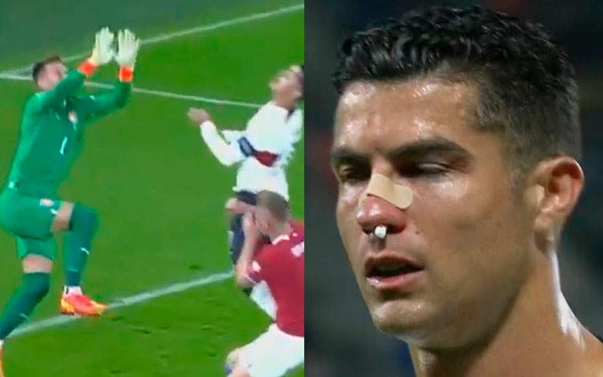 Cristiano Ronaldo sufrió duro golpe de portero de República Checa