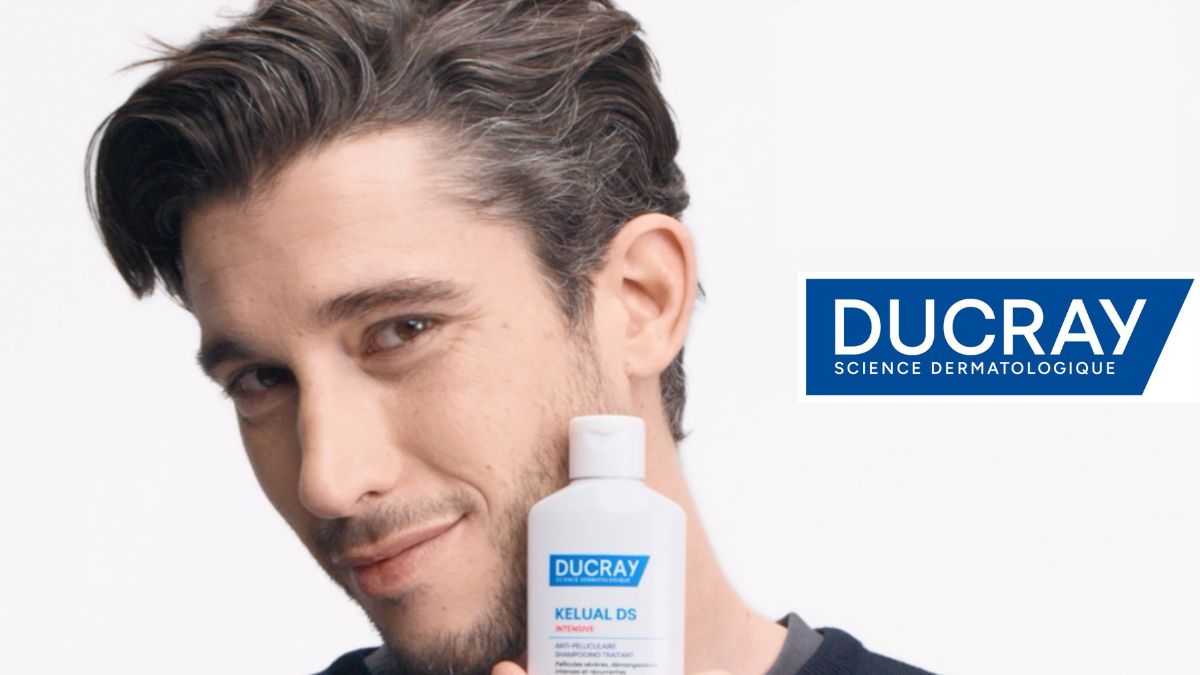 Caspa severa: el tema capilar del que ya nadie se avergüenza