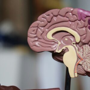 Alzheimer